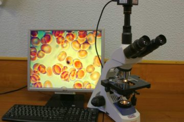 исследование крови под микроскопом